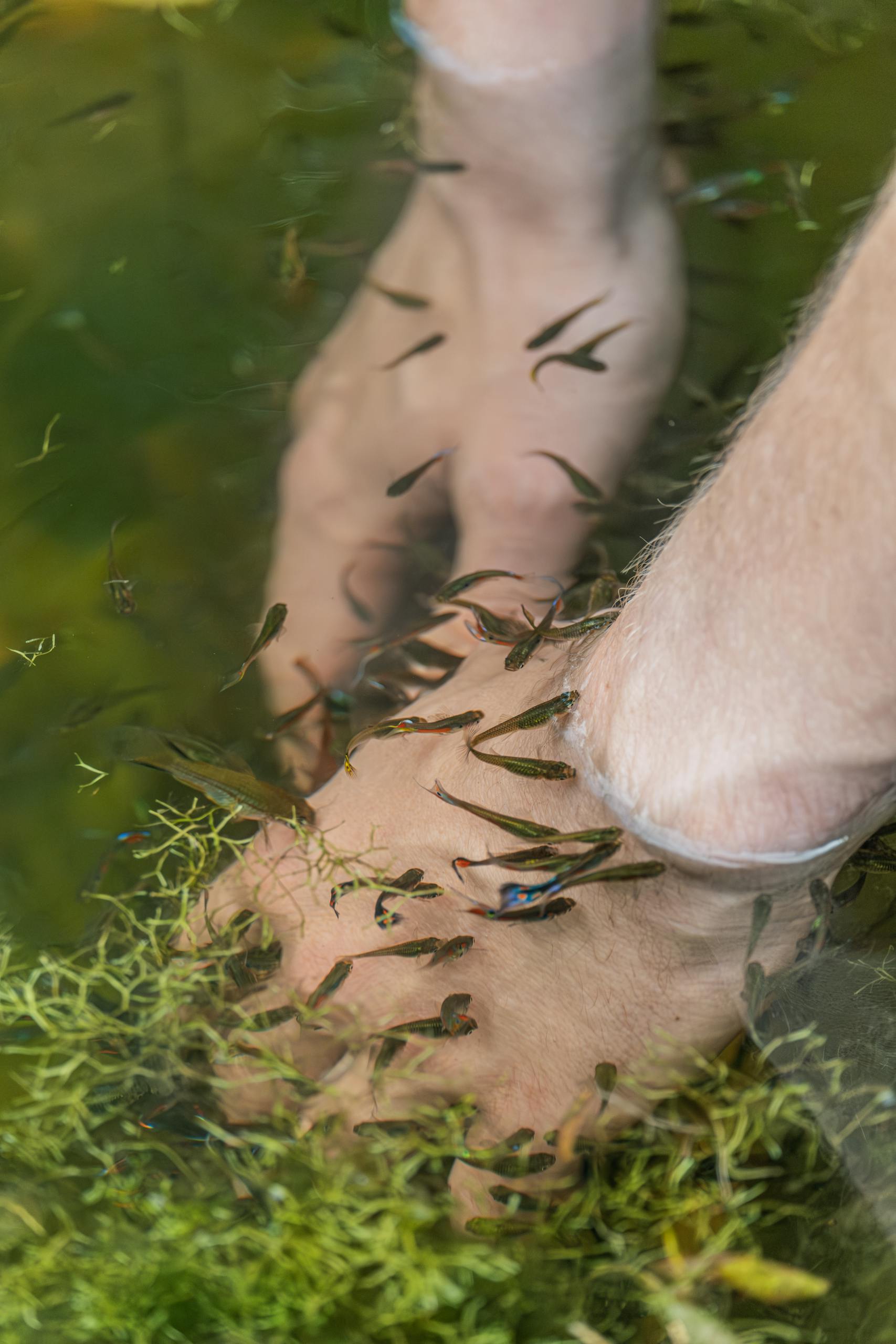Hands immersed in a fish spa surrounded by small fish, highlighting skin care therapy.